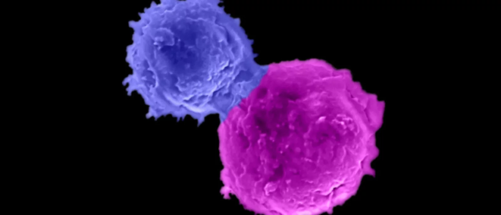 Microscopy image showing an allogeneic BCMA-targeting CAR-armed and IL-15-enhanced NKT cell (BCAR-NKT cell; blue) attacking a human multiple myeloma cell (MM.1S cell; magenta).